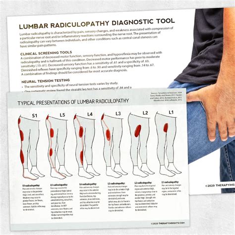 Lumbar radiculopathy dbq. Things To Know About Lumbar radiculopathy dbq. 
